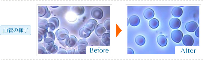 血管の様子  炭酸ヘッドスパ前後写真